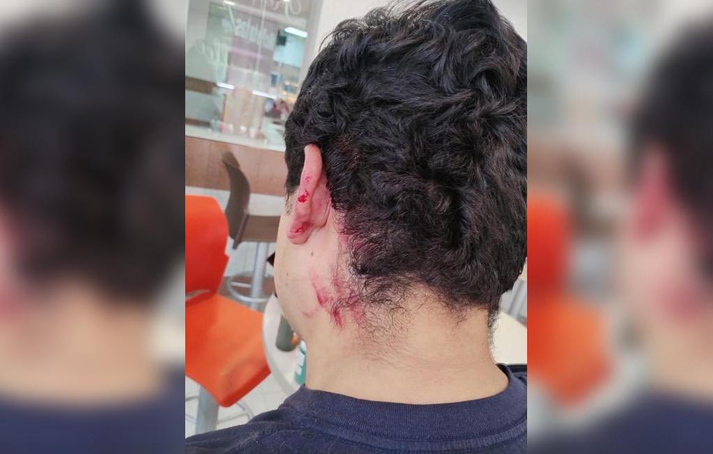 Reportan agresión contra un joven en restaurante de avenida Vallarta