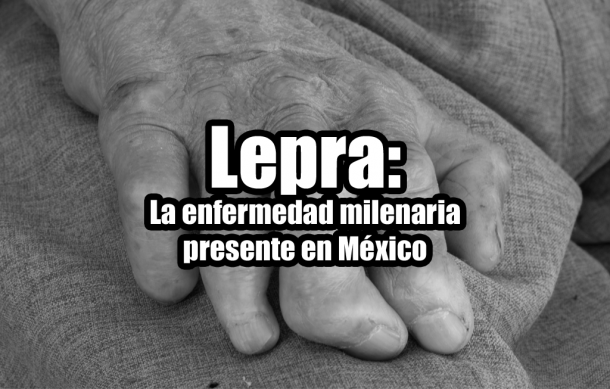 Lepra: La enfermedad milenaria presente en México