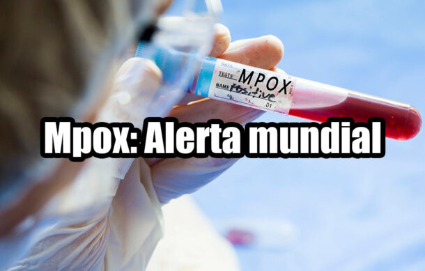 Mpox: Alerta mundial