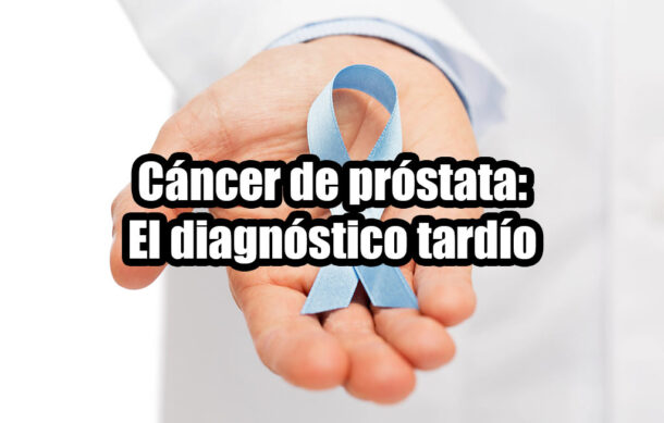 Cáncer de próstata: El diagnóstico tardío